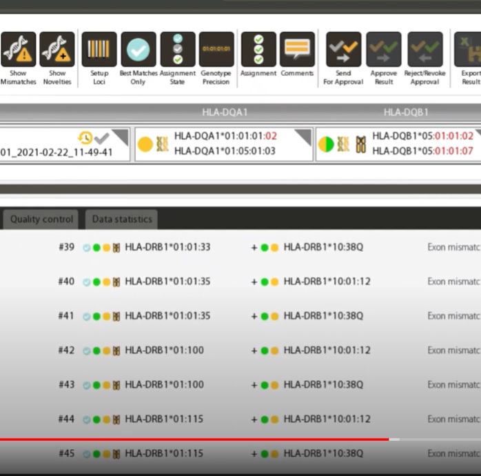 Benefícios do Software Twin HLA Omixon na Análise de Genotipagem HLA por NGS