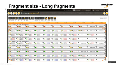 How to review and troubleshoot challenging samples in HLA Twin.